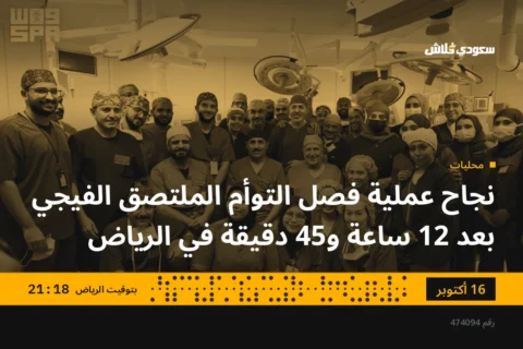 نجاح عملية فصل التوأم الملتصق الفيجي بعد 12 ساعة و45 دقيقة في الرياض